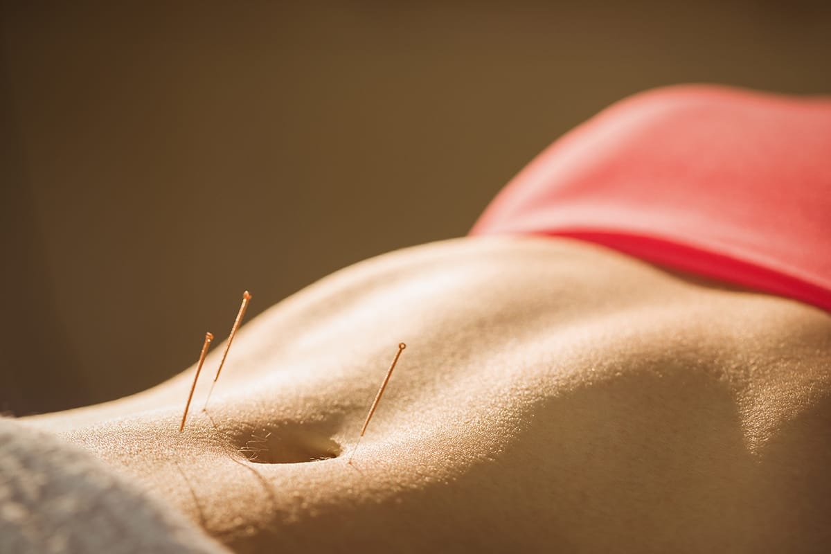 Acupuntura abdominal