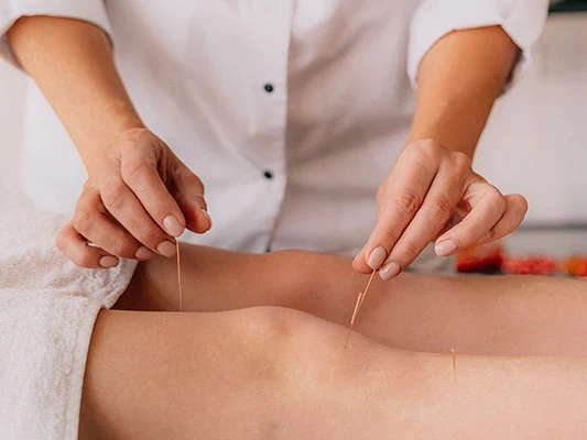 Acupuntura
