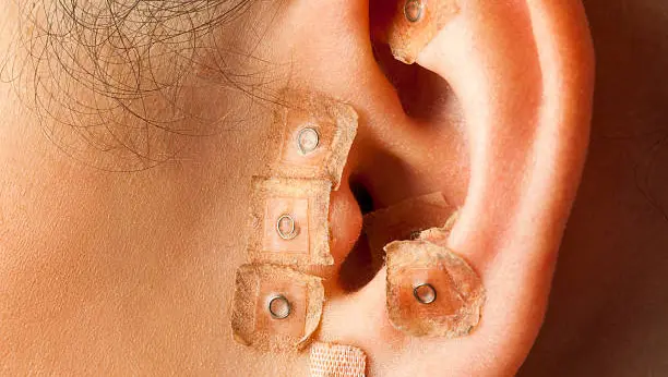 Auriculoterapia en Centro Qiromass